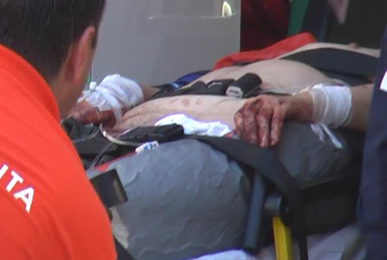 Un bărbat din Ipotești s-a tăiat cu flexul la mână în timp ce încerca să taie tocul unui geam