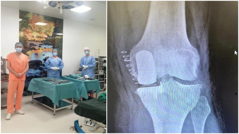 FOTO O nouă premieră în Spitalul Județean „Sf. Ioan cel Nou” Suceava: Protezare unicompartimentală a genunchiului