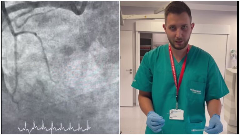 Un bărbat de 55 de ani  care suferise un infarct miocardic, a fost salvat de cardiologii intervenționiști suceveni, după o luptă contra cronometru: „A crescut adresabilitatea, oamenii se investighează, se informează, nu mai stau acasă să treacă durerea din piept”