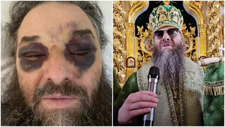 VIDEO Mitropolitul Longhin Jar de la Cernăuți a fost bătut cu sălbăticie. Autoritățile ucrainene susțin că preotul român ar fi căzut: „Au bătut la ușă de 3 ori, iar când am deschis, am primit o lovitură de la care mi-am pierdut cunoștința”