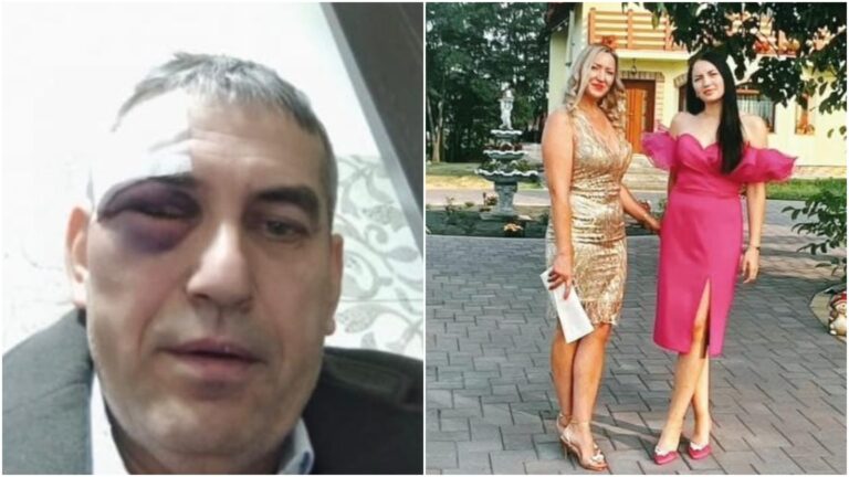 Concubina primarului Radu Reziuc își folosește fiica pentru a-și da afară partenerii din casă? Fostul soț a încasat o bătaie zdravănă de la iubitul fiicei lui și a fost evacuat după un incident banal