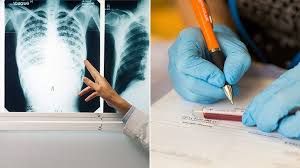 Caravana mobilă „Screening TB” ajunge în județul Suceava. Servicii medicale gratuite pentru depistarea tuberculozei în 20 de localități